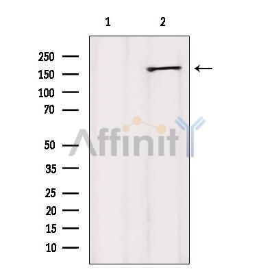 AF6489 staining Hela by IF/ICC. The sample were fixed with PFA and permeabilized in 0.1% Triton X-100,then blocked in 10% serum for 45 minutes at 25¡ãC. The primary antibody was diluted at 1/200 and incubated with the sample for 1 hour at 37¡ãC. An  Alexa Fluor 594 conjugated goat anti-rabbit IgG (H+L) Ab, diluted at 1/600, was used as the secondary antibod