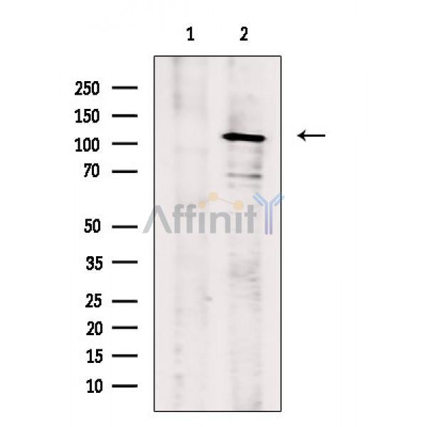 MORC2 Antibody -AF6501