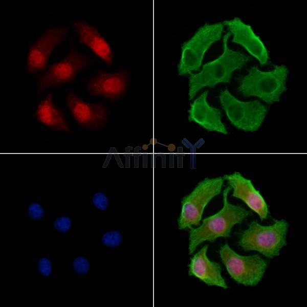TORC2 Antibody -AF6579