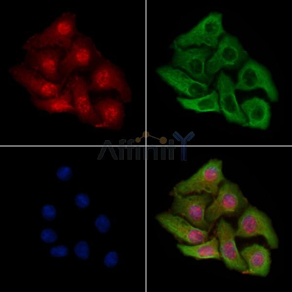 PFKFB3 Antibody -AF6581