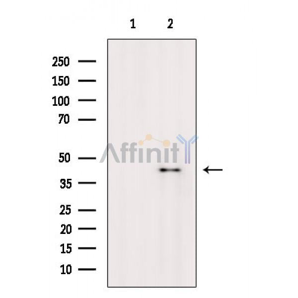 Kir6.2 Antibody -AF6590