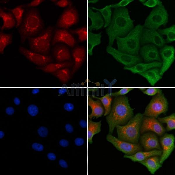 IP3 Receptor Antibody -AF6591