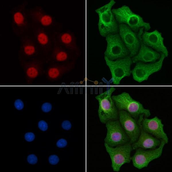 IRF5 Antibody -AF6599