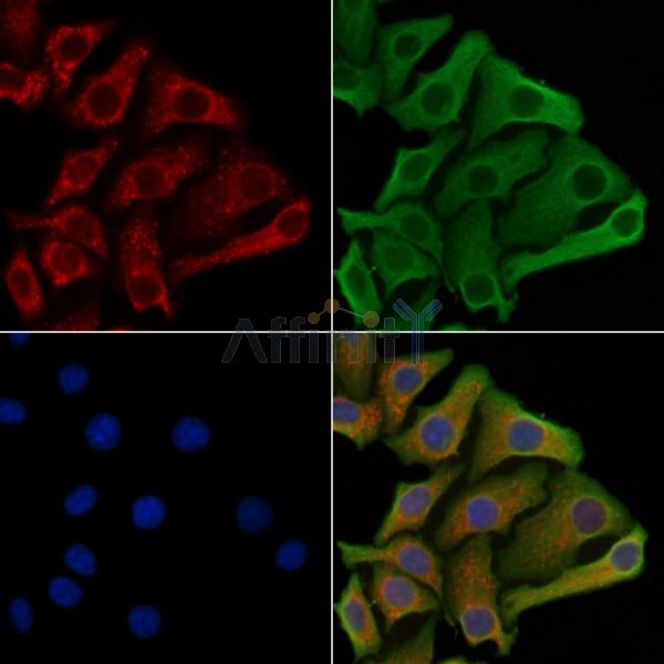 RIPK1 Antibody -AF6600