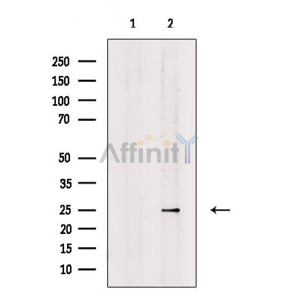 Rab8 Antibody -AF6644