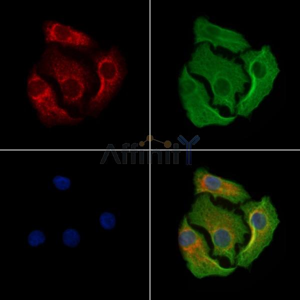 MARK3 Antibody -AF6686