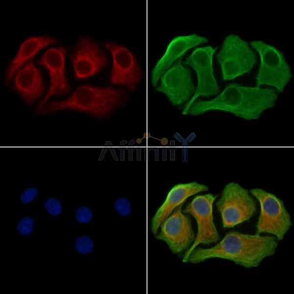 Hexokinase 1 Antibody -AF6709