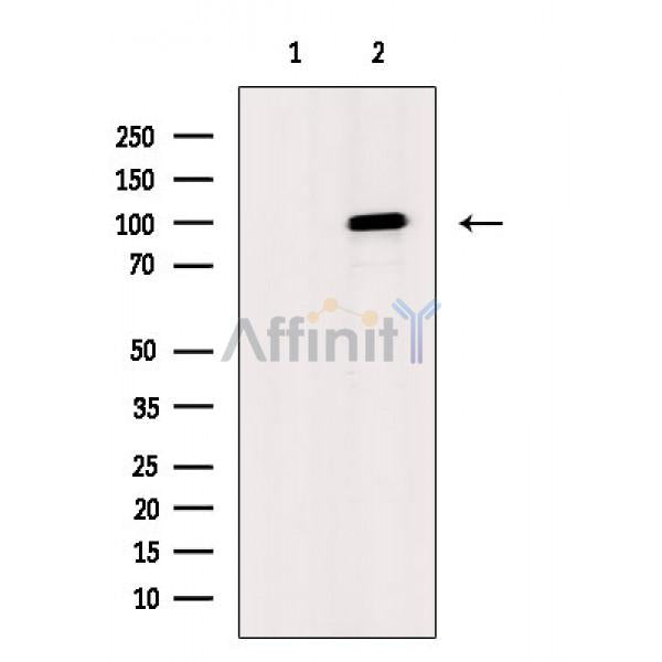 VEGFR1 Antibody -AF6711