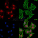RPA32/RPA2 Antibody -AF6721