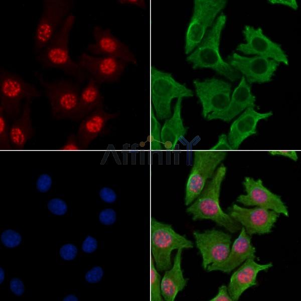 RPA32/RPA2 Antibody -AF6721
