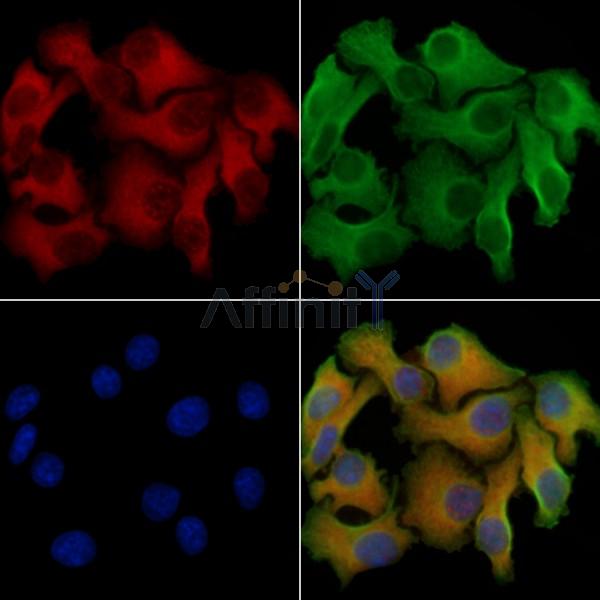 EPRS Antibody -AF6737