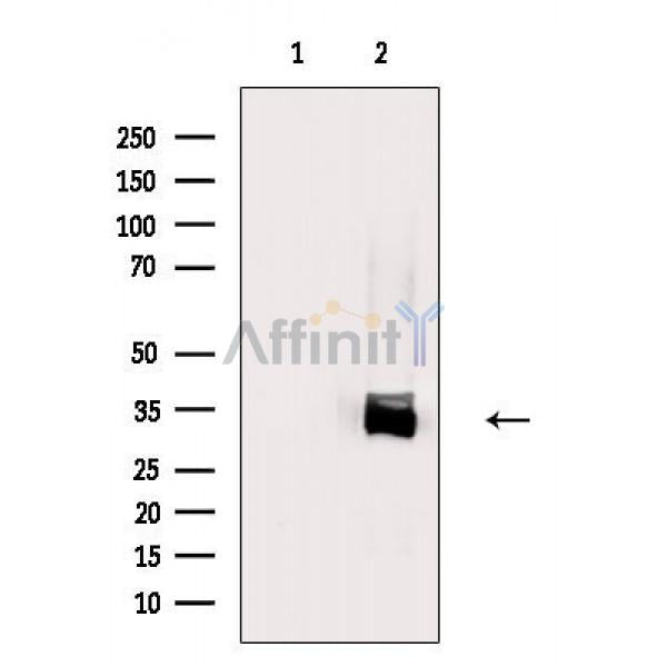 Nucleophosmin Antibody -AF6740