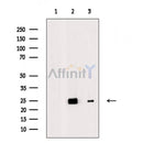 SOD2/MnSOD Antibody -AF6751