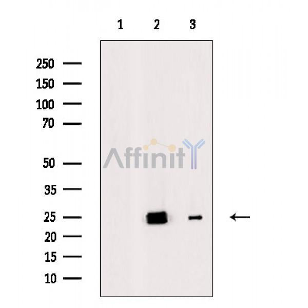 SOD2/MnSOD Antibody -AF6751