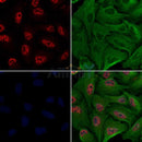 SNAIL Antibody -AF6756