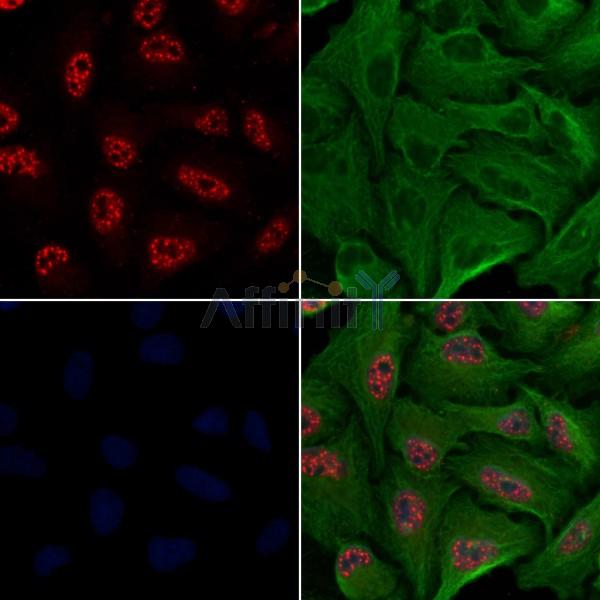 SNAIL Antibody -AF6756