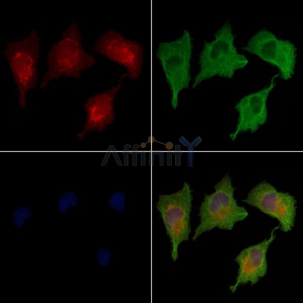 ABCA1 Antibody -AF6758