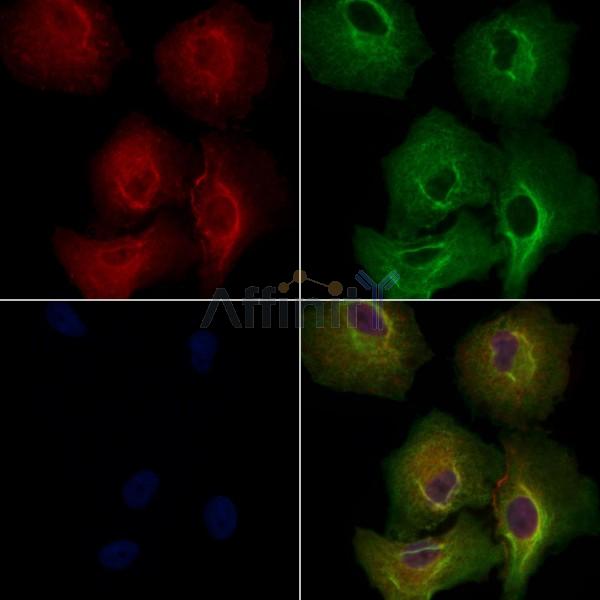 SCD1 Antibody -AF6781