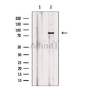 eEF2K Antibody -AF6785