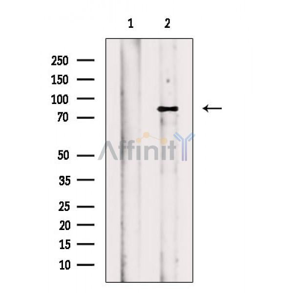 eEF2K Antibody -AF6785