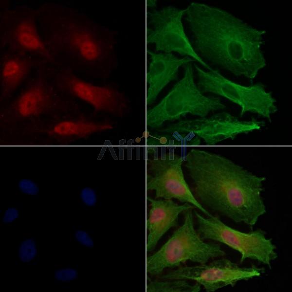 SGK1 Antibody -AF6789