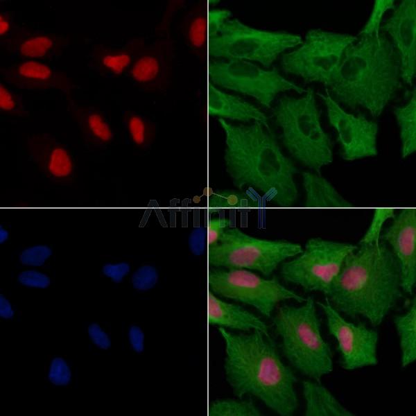 NF-kB p65 Antibody -AF6795