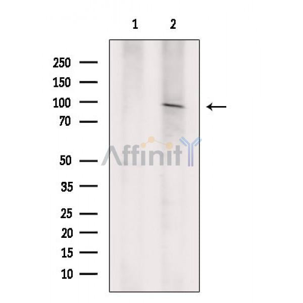 FER Antibody -AF6796