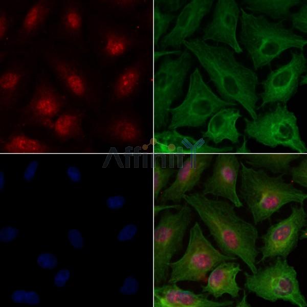 beta Catenin Antibody -AF6797