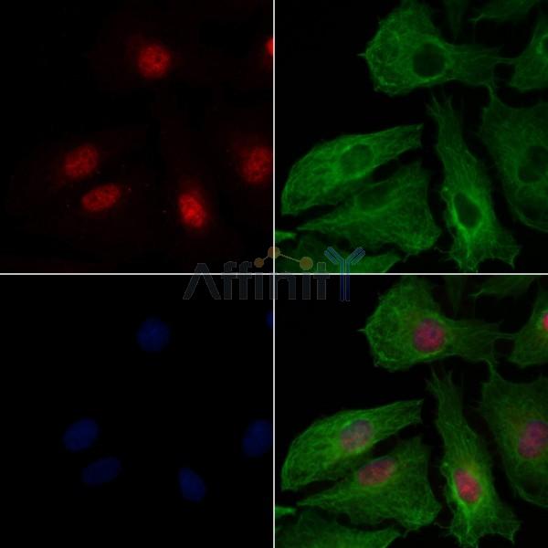 NFAT5 Antibody -AF6798
