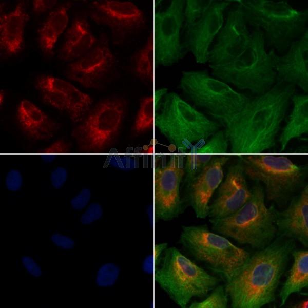 HER3/ErbB3 Antibody -AF6802