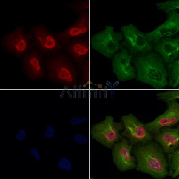 MKK3/MKK6 Antibody -AF6804