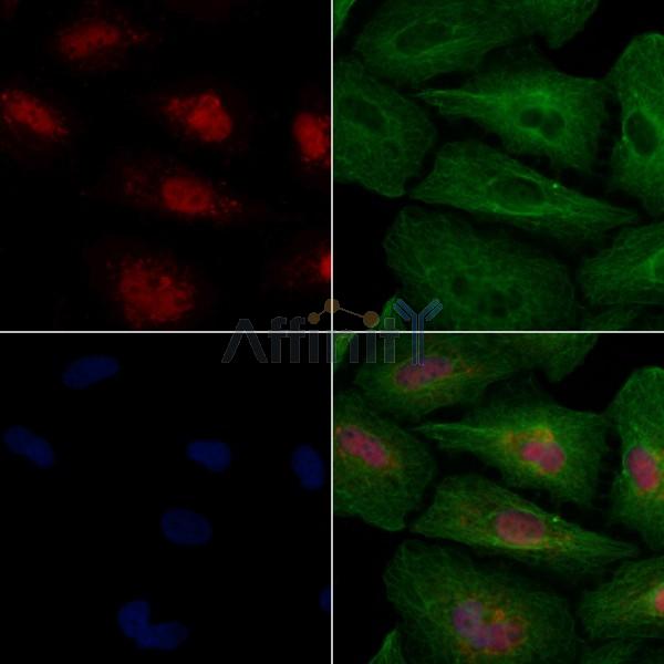 MKK3/MKK6 Antibody -AF6805