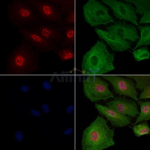 JIP1 Antibody -AF6812