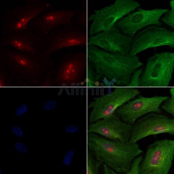 ICK Antibody -AF6816