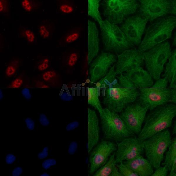 TDP43 Antibody -AF6832