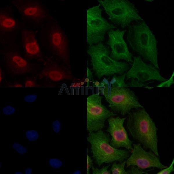 PKM2 Antibody -AF6833