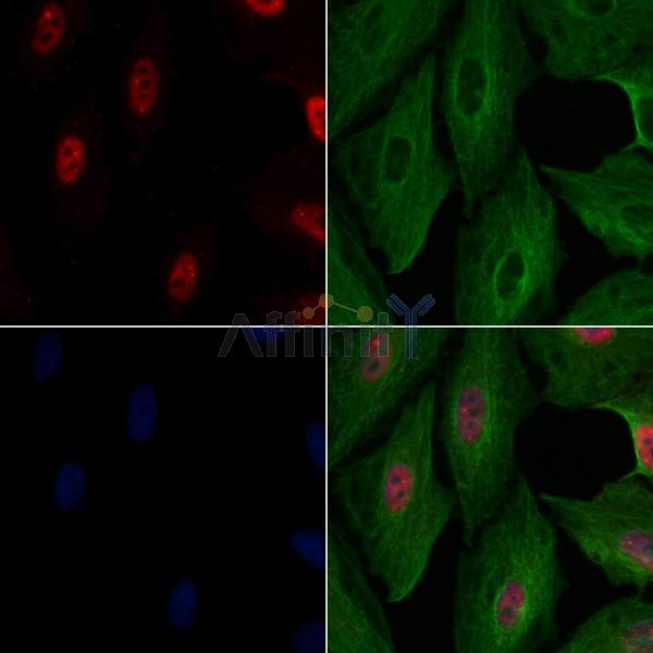 ZEB2 Antibody -AF6840
