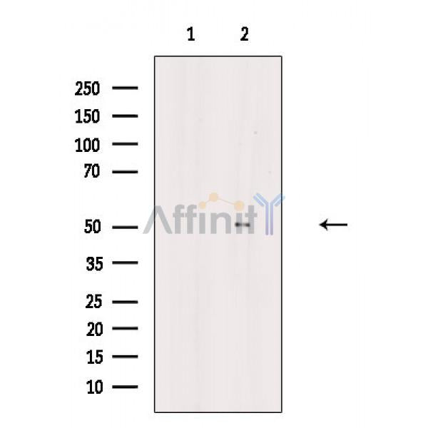 Cytokeratin 18 Antibody -AF6849