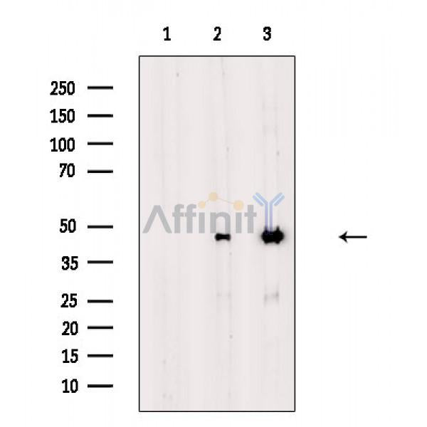 Cytokeratin 18 Antibody -AF6850