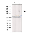 PYGL Antibody -AF6863
