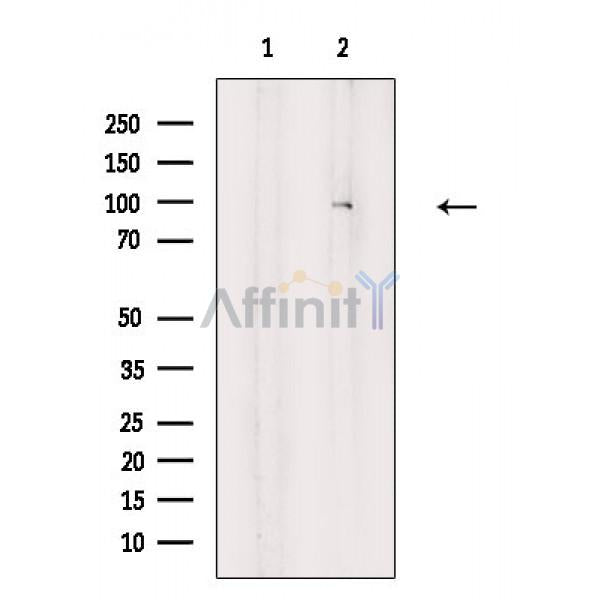 PYGL Antibody -AF6863