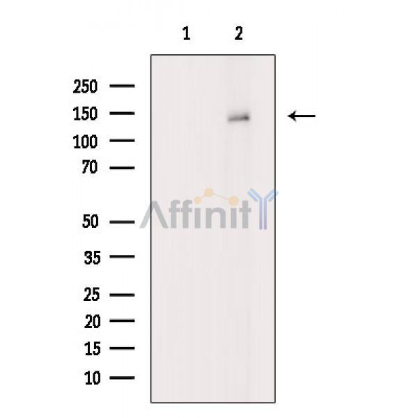 PKD1/PKC mu Antibody -AF6867