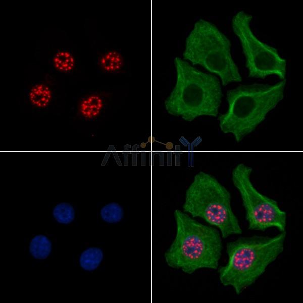Tau Antibody -AF6913