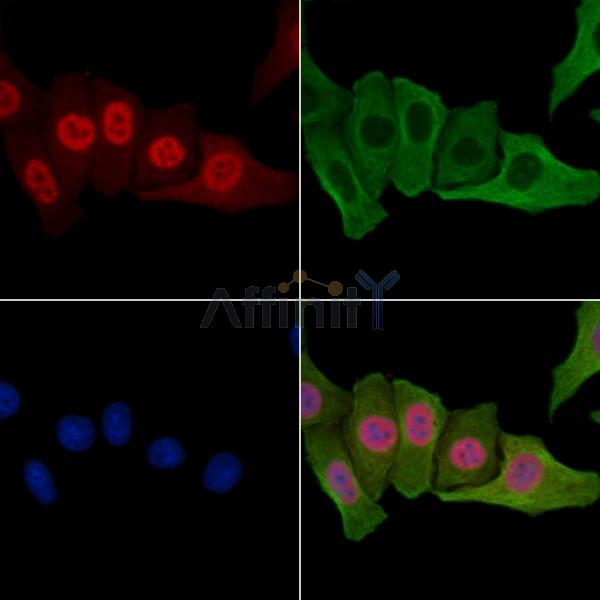 BRCA2 Antibody -AF6914