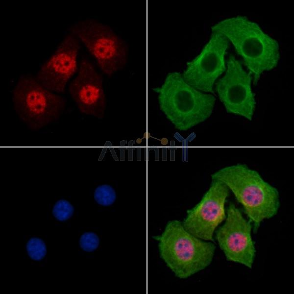 C-RAF Antibody -AF6969