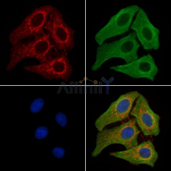 Estrogen Receptor alpha Antibody -AF6973