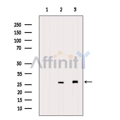 Western blot analysis of extracts from mouse brain, using TIMP4 Antibody.