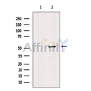AF7012 at 1/100 staining Human prostate tissue by IHC-P. The sample was formaldehyde fixed and a heat mediated antigen retrieval step in citrate buffer was performed. The sample was then blocked and incubated with the antibody for 1.5 hours at 22¡ãC. An HRP conjugated goat anti-rabbit antibody was used as the secondary