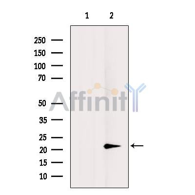 Western blot analysis of extracts from 293t, using VEGFB Antibody. The lane on the left was treated with blocking peptide.

Observed bands: 17 kDa.