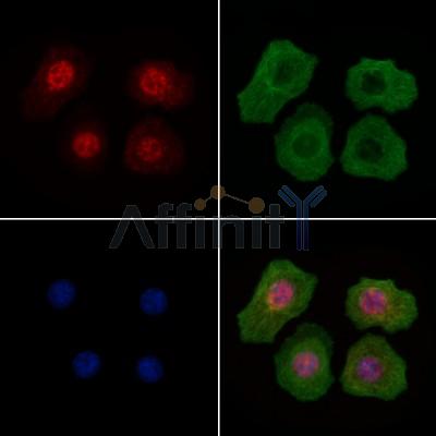 Phospho-IRF3 (Ser396) Antibody -AF7456